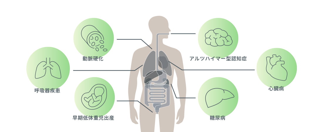 歯周病と全身疾患の関係図